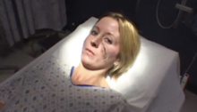 Bruised woman lying on a hospital gurney