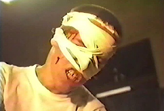 Guy with bandages all over his face grimacing in pain