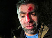 Usama Alshaibi with a bloody face after being beaten